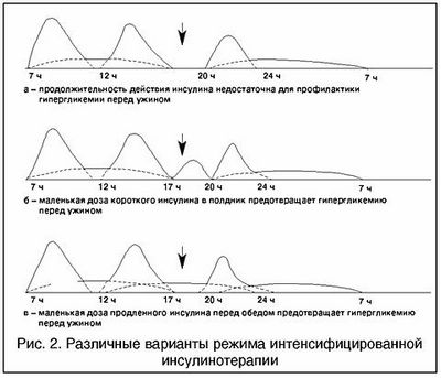 несахарный диабет у детей