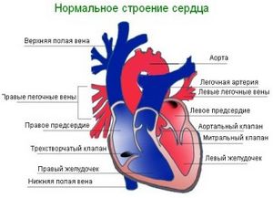 Пороки развития сердца у детей