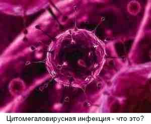 Ацикловир при цитомегаловирусной инфекции у детей