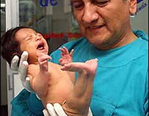 дети рожденные с гипоксией фото