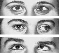 астигматизм обоих глаз у детей