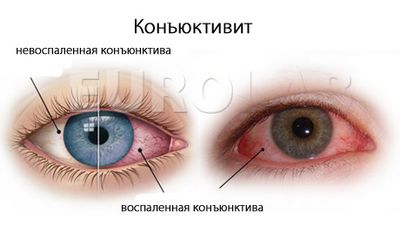 диагностика зрения у детей минск