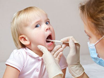 заболевания горла у детей симптомы