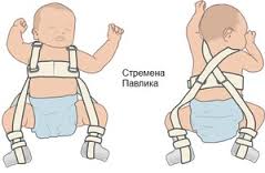 сделать узи тазобедренных суставов ребенку минск