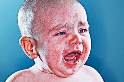аллергия в паху у ребенка до года фото