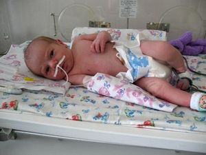 Пневмония у 5 месячного ребенка