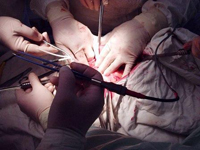 операция гидронефроза у детей в новосибирске