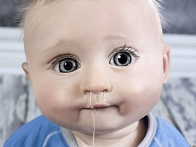 заложенность носа у ребенка 1 год